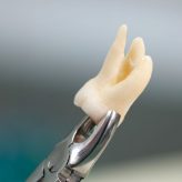 Feature (6) extraction